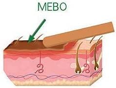 كريم MEBO